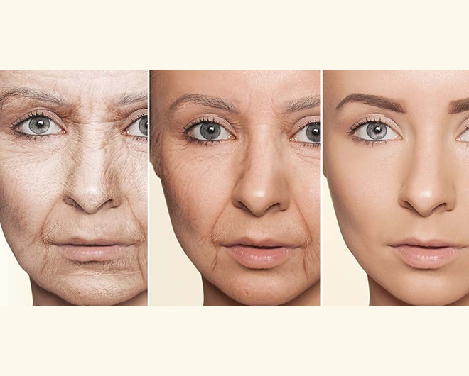 Anti-aging & Beauty